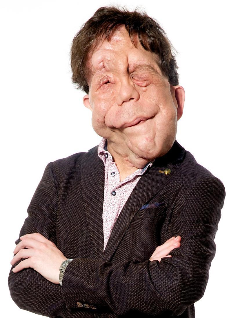 Adam Pearson image