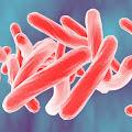 Tuberculosis profile photo